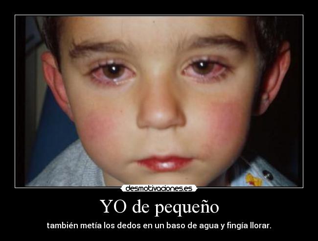 YO de pequeño - también metía los dedos en un baso de agua y fingía llorar.