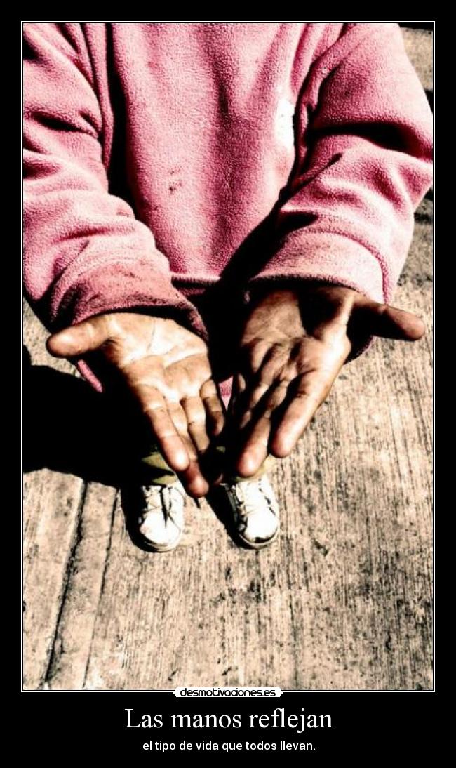 Las manos reflejan - el tipo de vida que todos llevan.