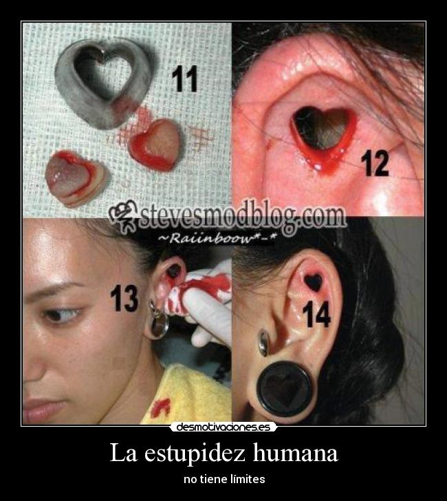 La estupidez humana - 