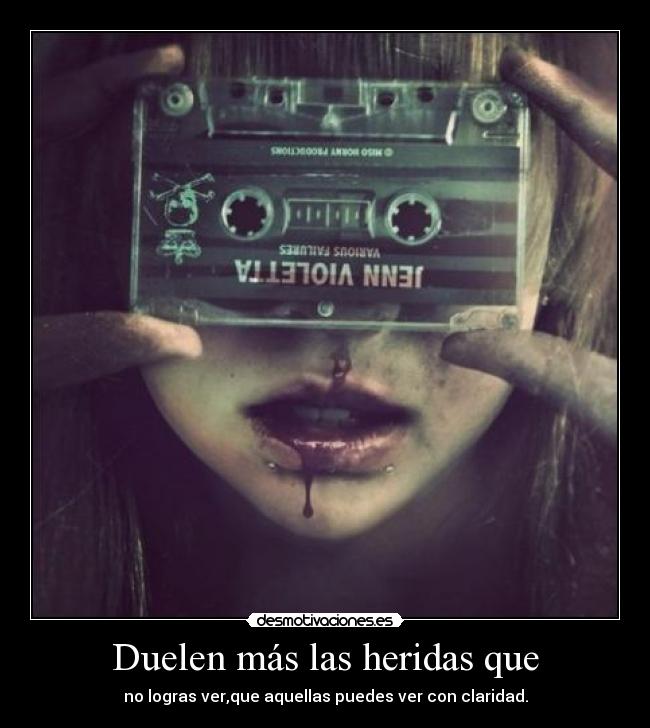 Duelen más las heridas que -