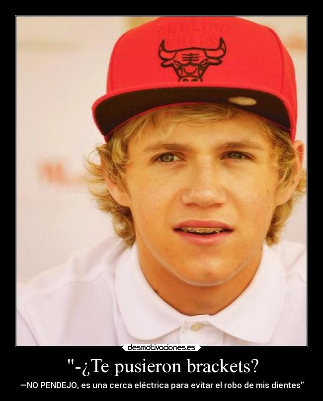 -¿Te pusieron brackets? -