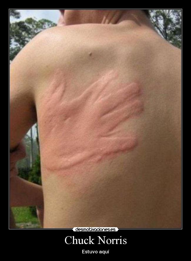 Chuck Norris -
