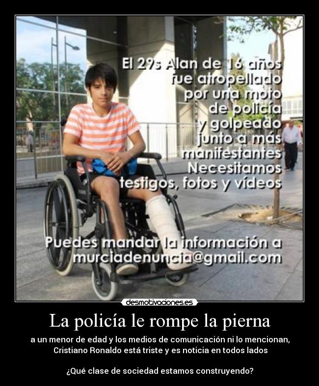 La policía le rompe la pierna - 