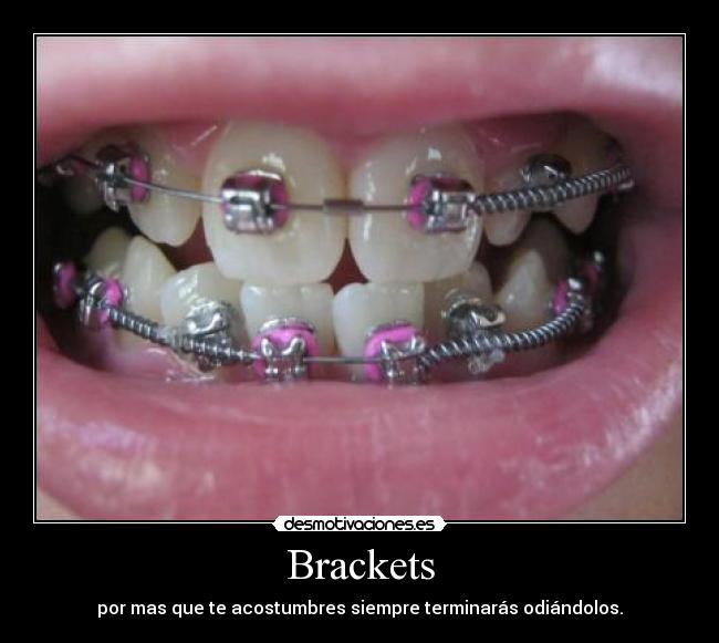 Brackets -