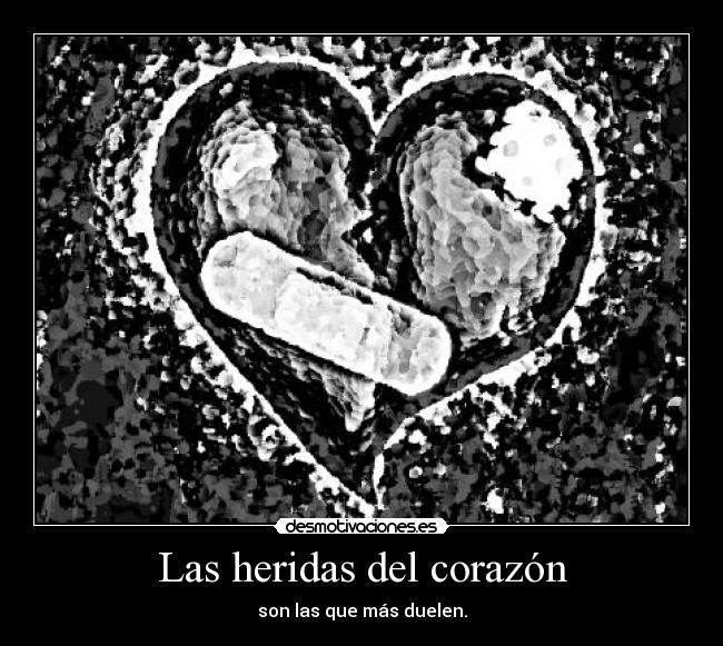 Las heridas del corazón - son las que más duelen.