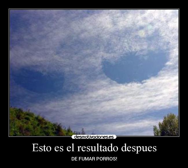 Esto es el resultado despues - DE FUMAR PORROS!