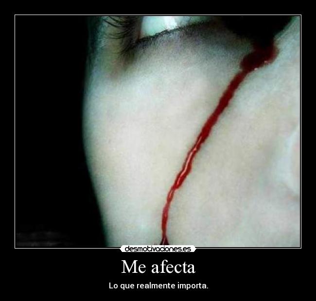 Me afecta - 