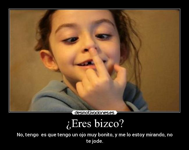 ¿Eres bizco? - 