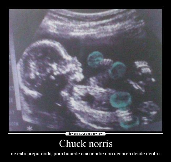 Chuck norris -
