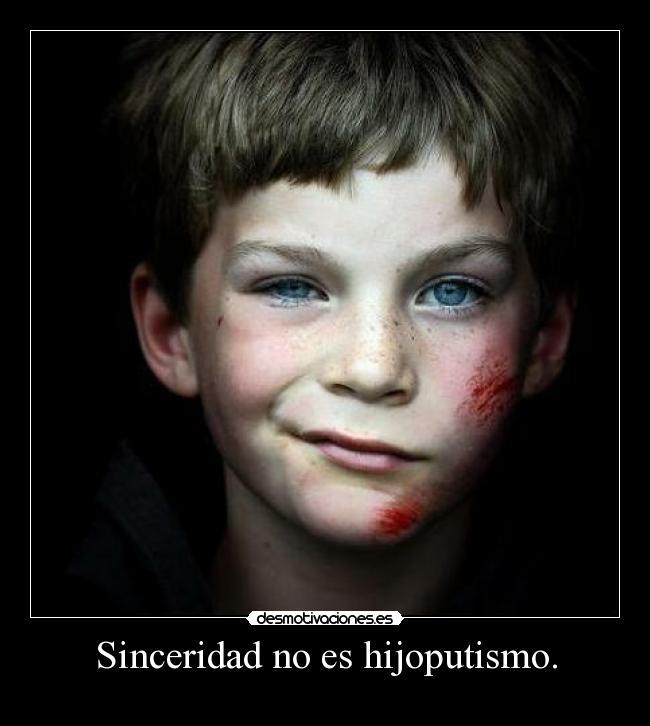 Sinceridad no es hijoputismo. -