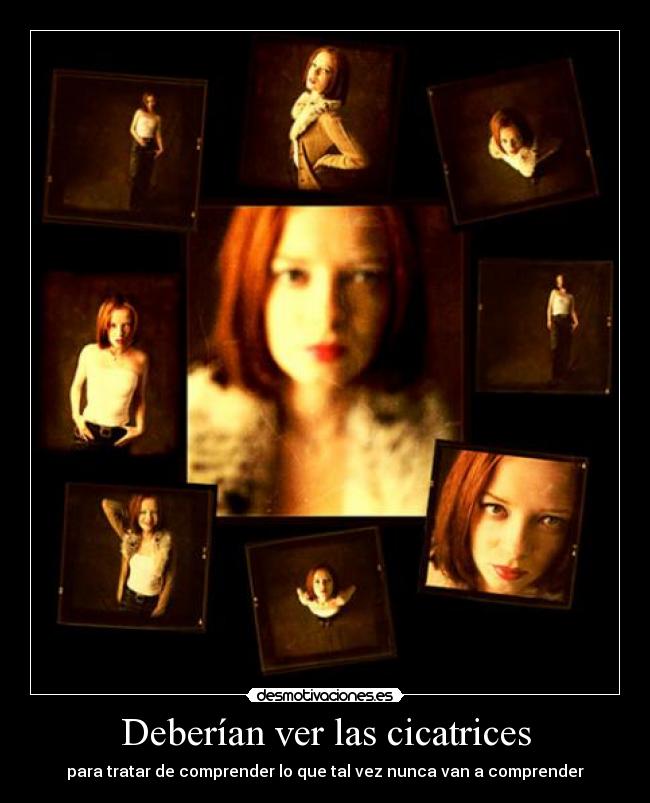 Deberían ver las cicatrices -