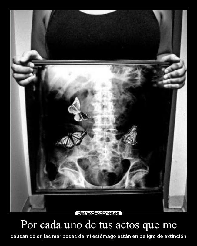 Por cada uno de tus actos que me - causan dolor, las mariposas de mi estómago están en peligro de extinción.