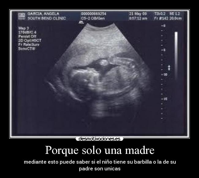 Porque solo una madre - mediante esto puede saber si el niño tiene su barbilla o la de su padre son unicas
