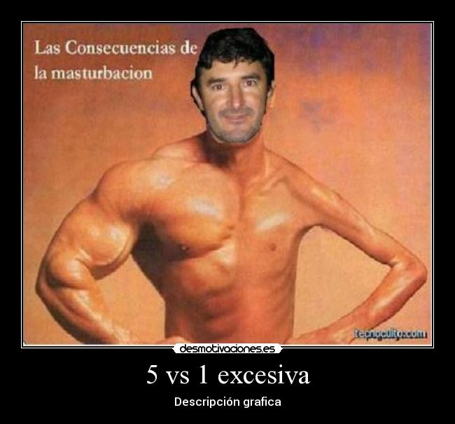 5 vs 1 excesiva - Descripción grafica