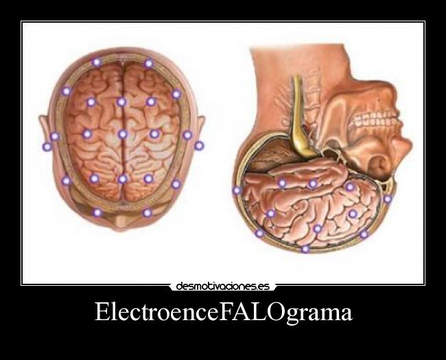 ElectroenceFALOgrama - 