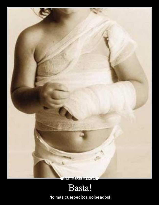 Basta! - No más cuerpecitos golpeados!
