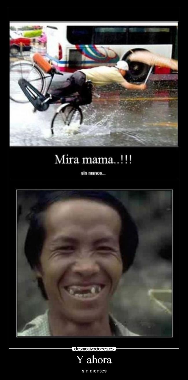 Y ahora - sin dientes