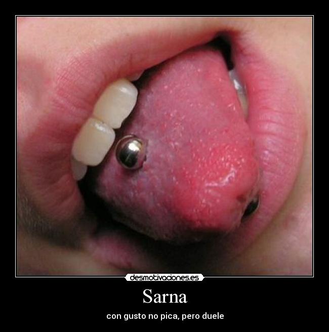 Sarna - con gusto no pica, pero duele