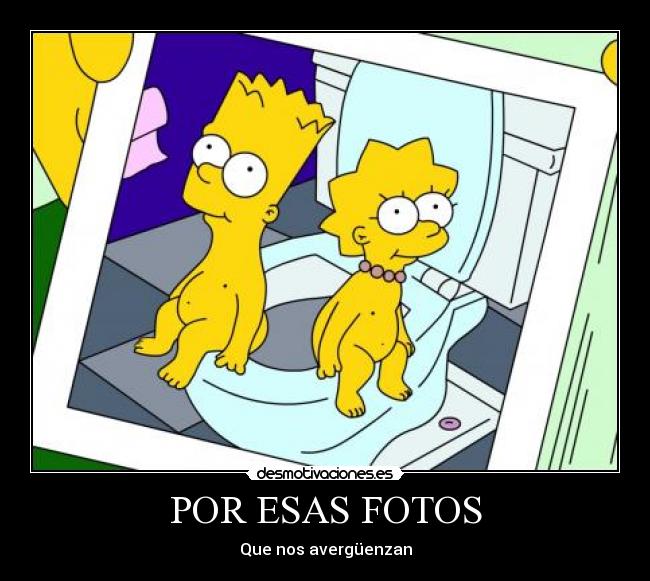 POR ESAS FOTOS - 