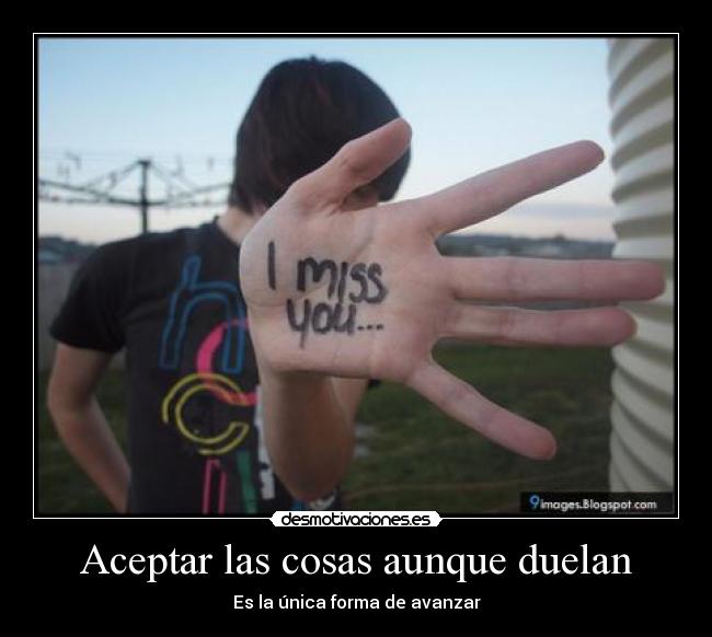 Aceptar las cosas aunque duelan -