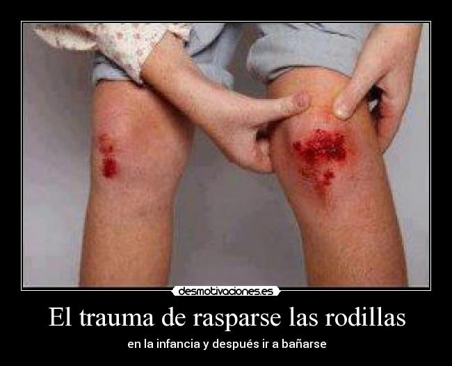 El trauma de rasparse las rodillas -