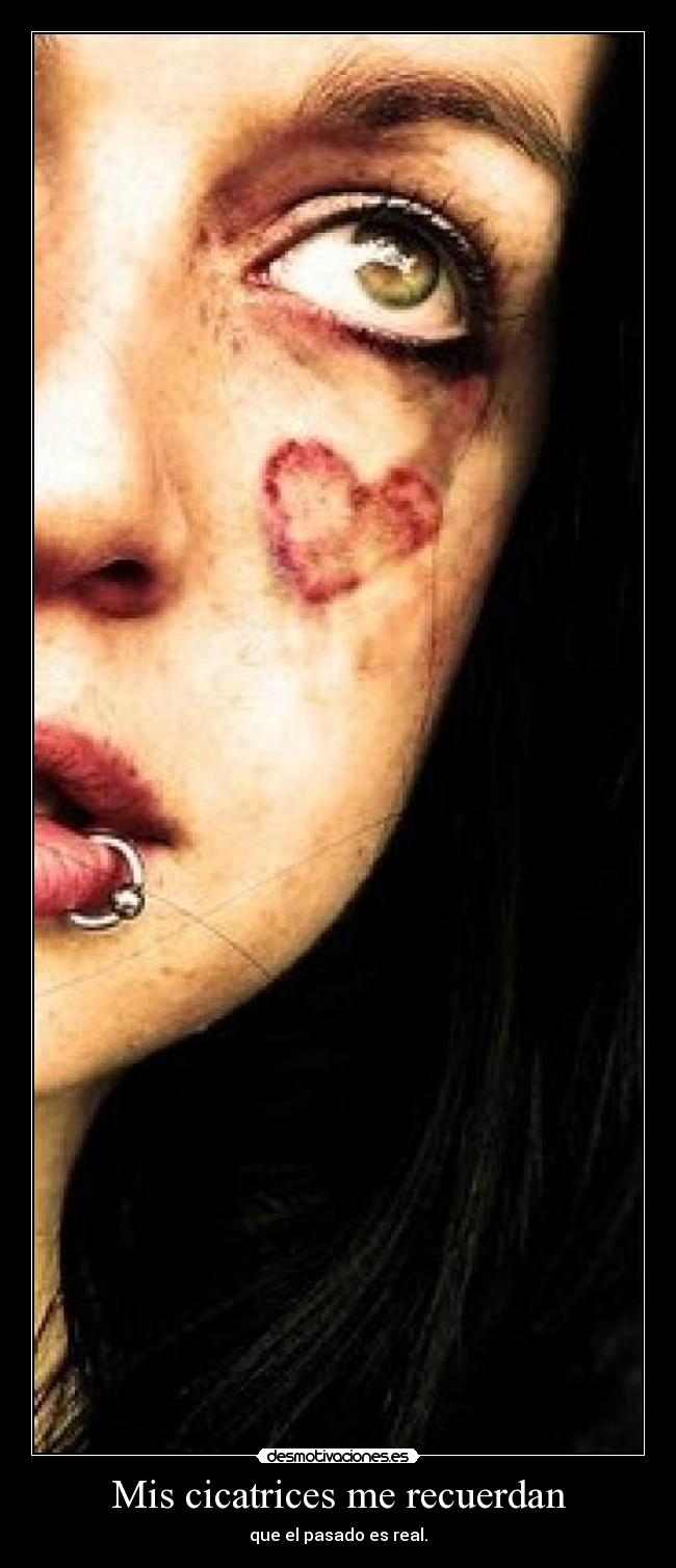 Mis cicatrices me recuerdan - 