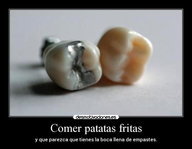 Comer patatas fritas - y que parezca que tienes la boca llena de empastes.