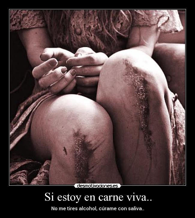 Si estoy en carne viva.. -