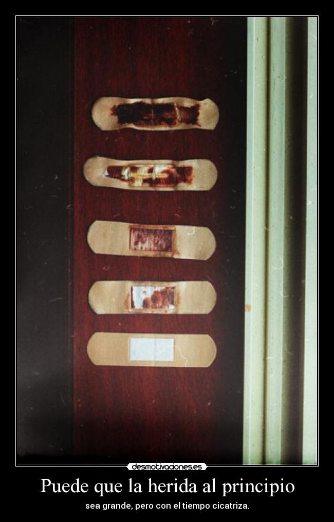 Puede que la herida al principio - 