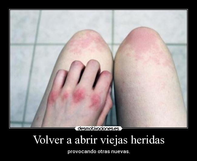 Volver a abrir viejas heridas - provocando otras nuevas.