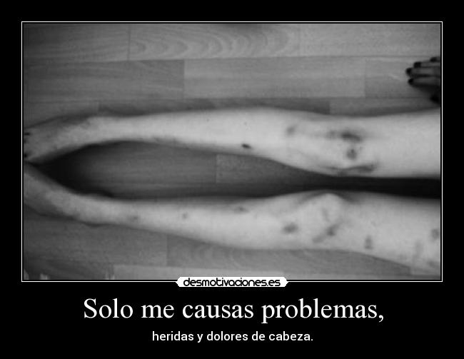 Solo me causas problemas, - heridas y dolores de cabeza.