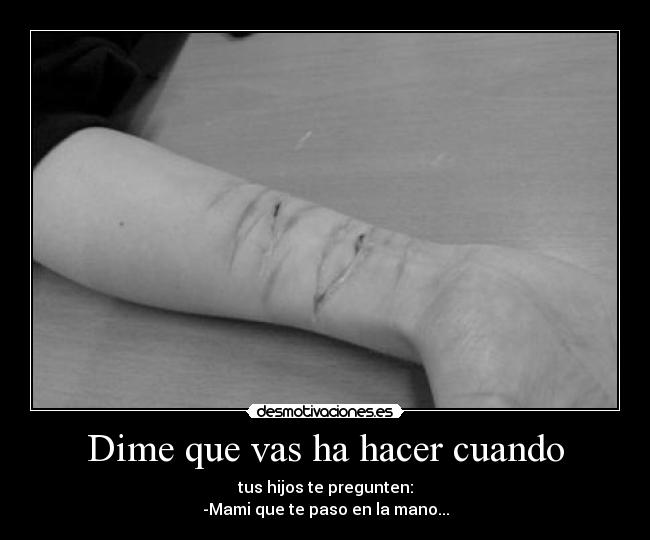 Dime que vas ha hacer cuando - tus hijos te pregunten:
-Mami que te paso en la mano...