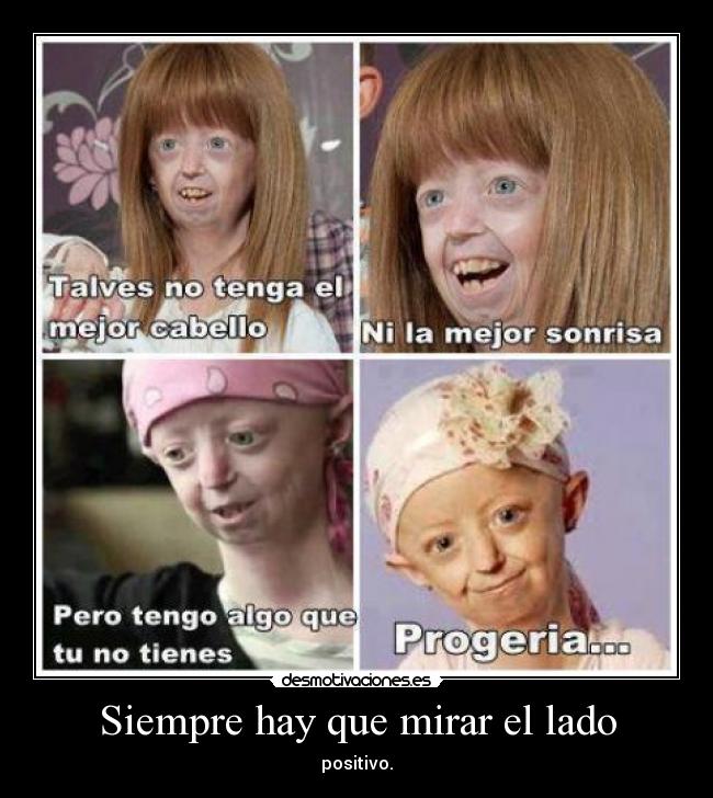 Siempre hay que mirar el lado - 