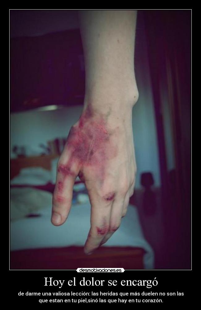 carteles dolor corpsegirl lfem pain whit love olvidad eso lol mucho desmotivaciones