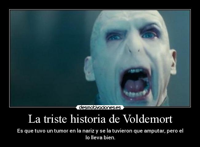 La triste historia de Voldemort - Es que tuvo un tumor en la nariz y se la tuvieron que amputar, pero el lo lleva bien.