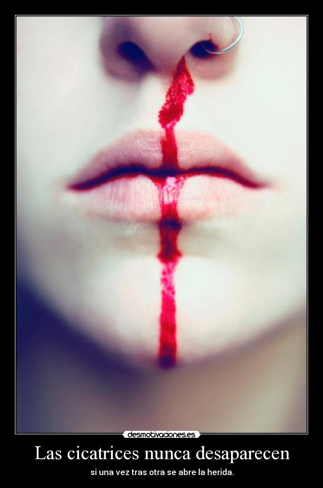 Las cicatrices nunca desaparecen - si una vez tras otra se abre la herida.
