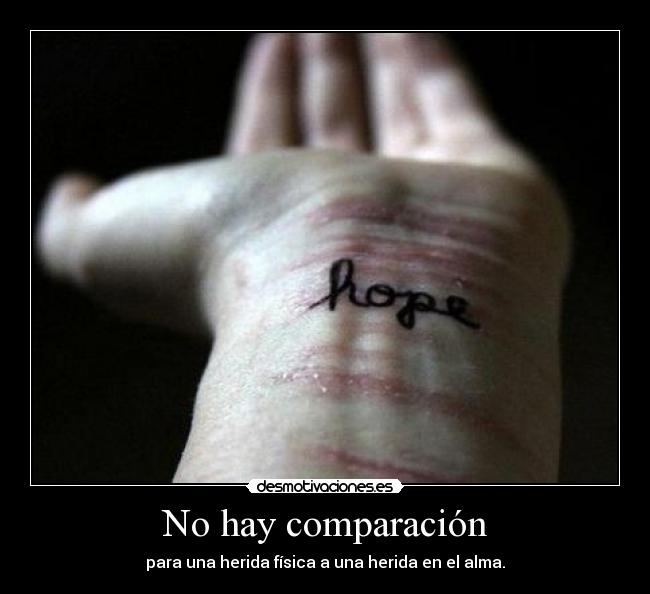 No hay comparación - 