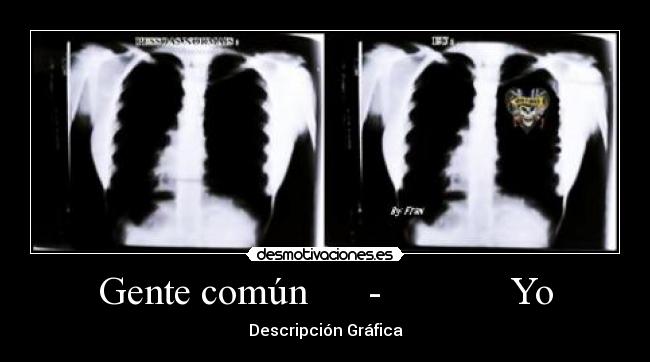 Gente común - Yo - Descripción Gráfica