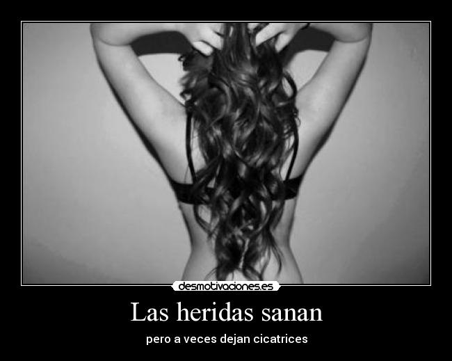 Las heridas sanan -