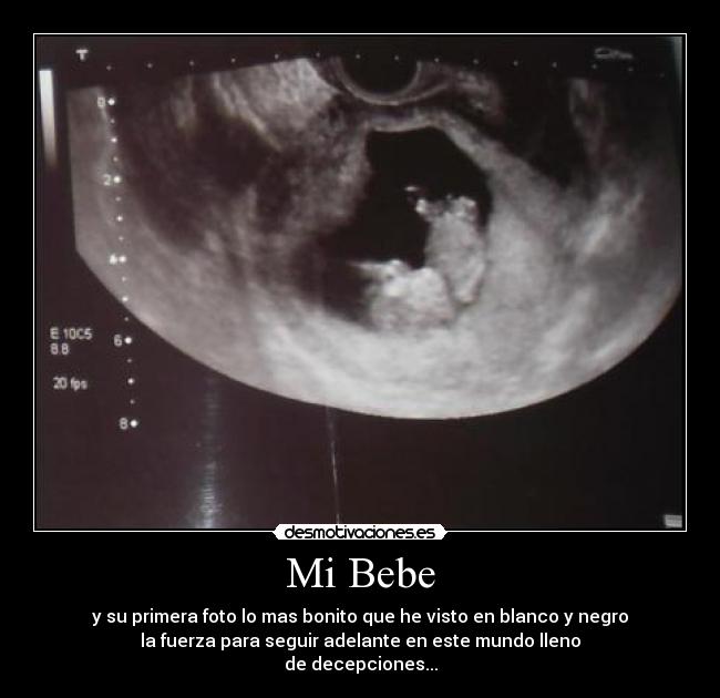 Mi Bebe | Desmotivaciones