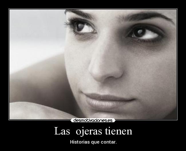 Las  ojeras tienen - Historias que contar.