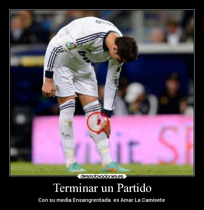 Terminar un Partido - Con su media Ensangrentada es Amar La Camisete ♥