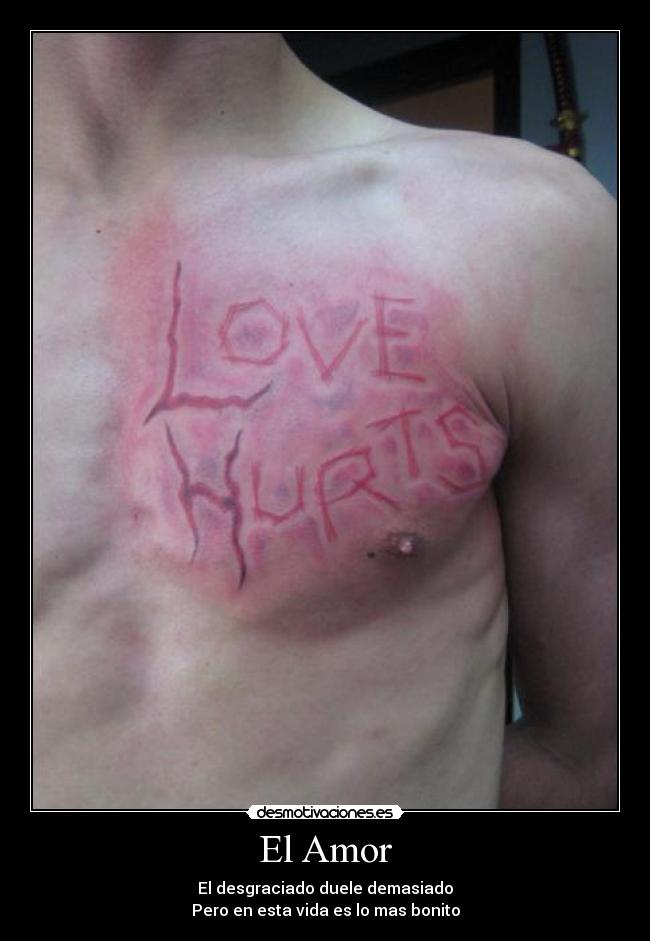 El Amor - El desgraciado duele demasiado
Pero en esta vida es lo mas bonito