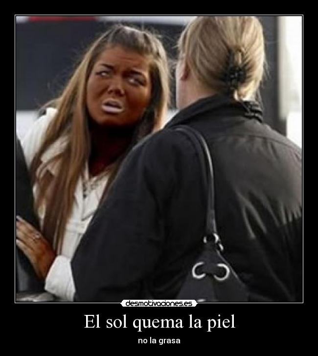 El sol quema la piel -