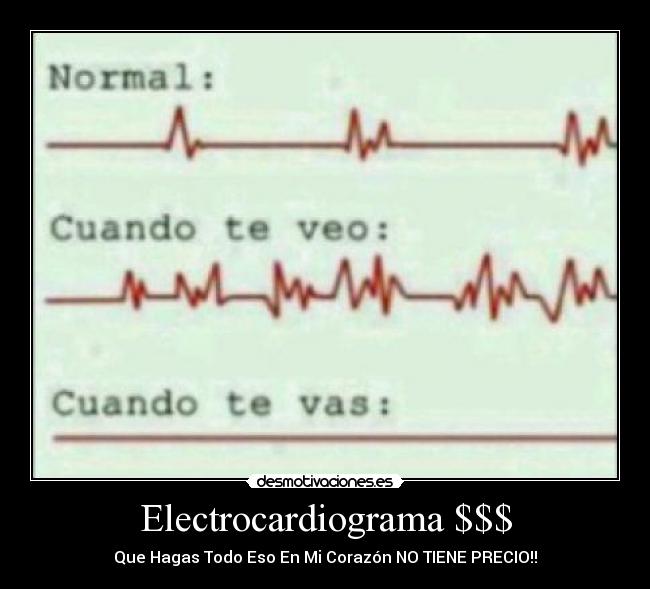 Electrocardiograma $$$ -