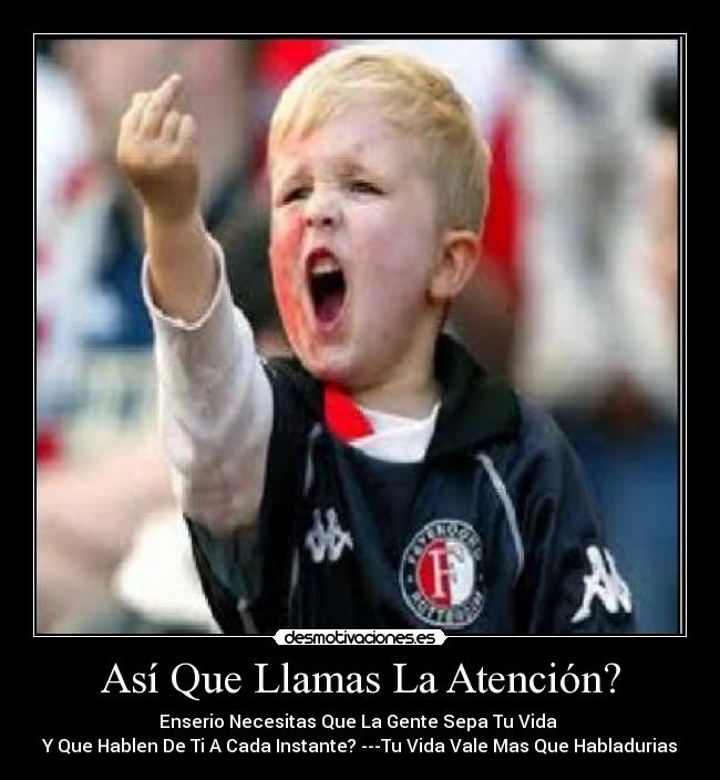 Así Que Llamas La Atención? -