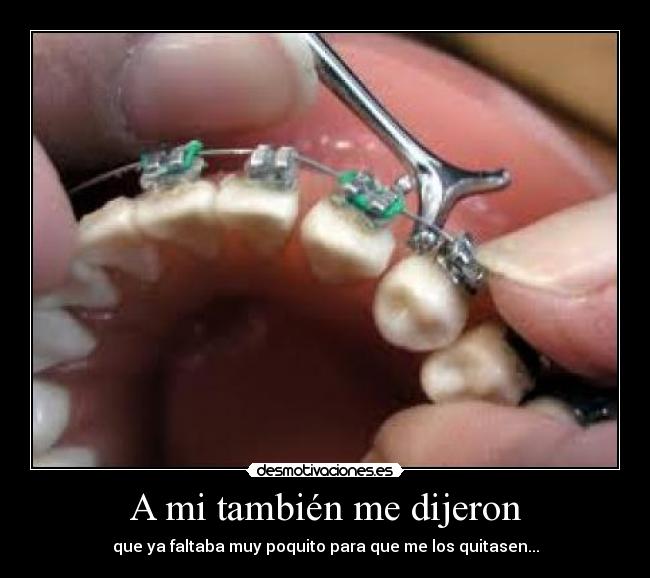 A mi también me dijeron - que ya faltaba muy poquito para que me los quitasen...