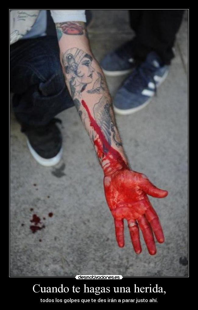 Cuando te hagas una herida, - todos los golpes que te des irán a parar justo ahí.