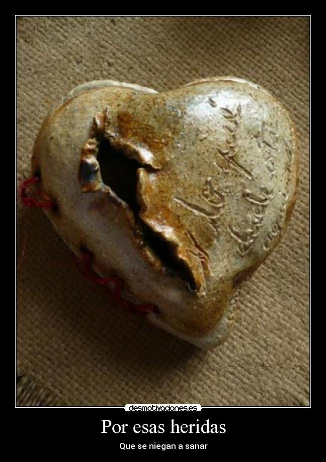 Por esas heridas -