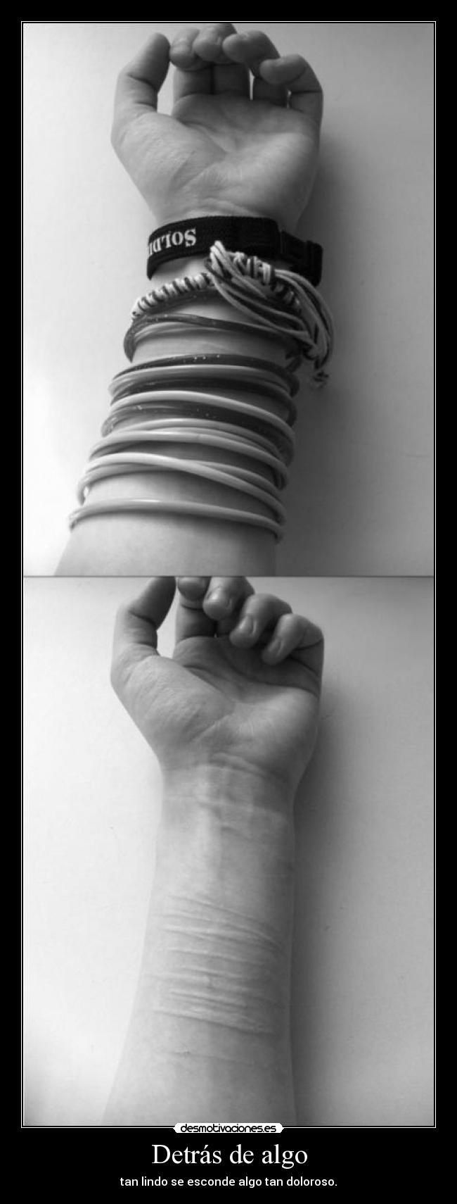 Detrás de algo - tan lindo se esconde algo tan doloroso.